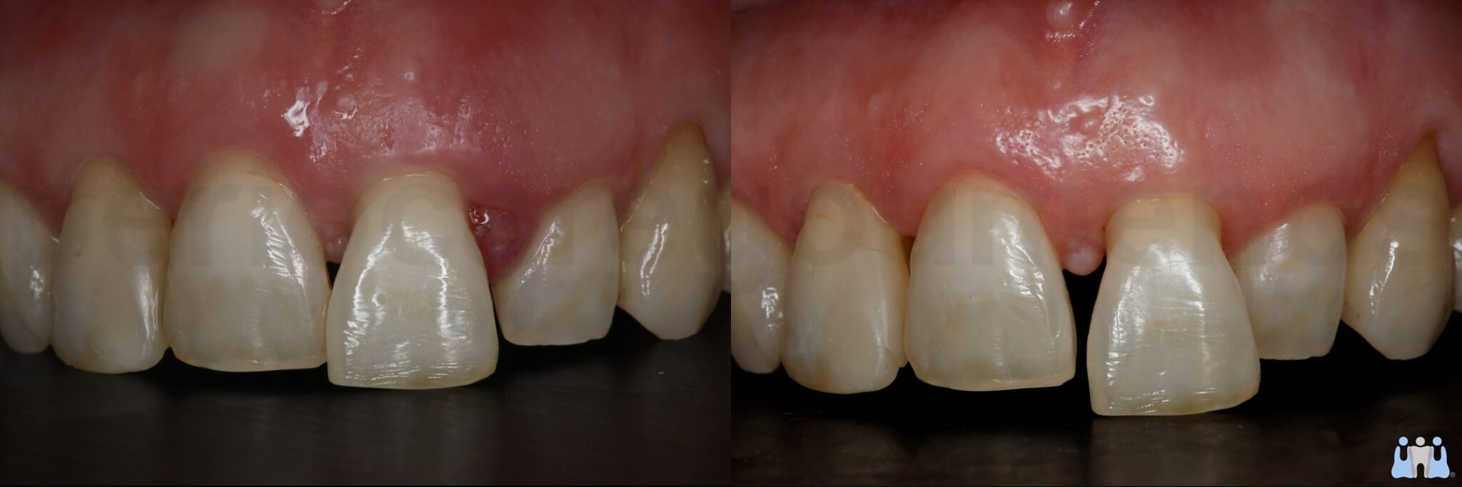Contemporary periodontal treatment